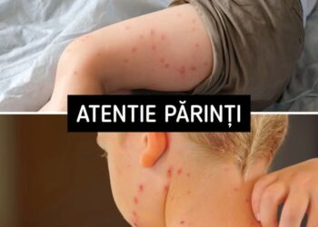 ATENȚIE! Acesta este primul simptom al… Vezi mai multe!